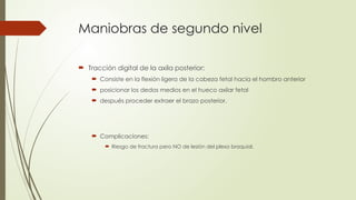 Maniobras de segundo nivel
 Tracción digital de la axila posterior:
 Consiste en la flexión ligera de la cabeza fetal hacia el hombro anterior
 posicionar los dedos medios en el hueco axilar fetal
 después proceder extraer el brazo posterior.
 Complicaciones:
 Riesgo de fractura pero NO de lesión del plexo braquial.
 