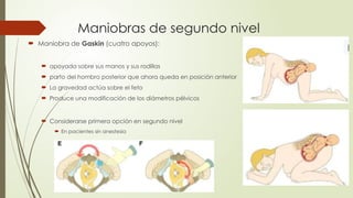 Maniobras de segundo nivel
 Maniobra de Gaskin (cuatro apoyos):
 apoyada sobre sus manos y sus rodillas
 parto del hombro posterior que ahora queda en posición anterior
 La gravedad actúa sobre el feto
 Produce una modificación de los diámetros pélvicos
 Considerarse primera opción en segundo nivel
 En pacientes sin anestesia
 