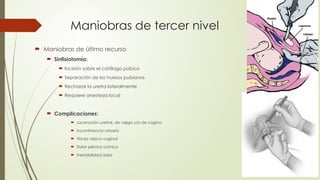 Maniobras de tercer nivel
 Maniobras de último recurso
 Sinfisiotomía:
 Incisión sobre el cartílago púbico
 Separación de los huesos pubianos
 Rechazar la uretra lateralmente
 Requiere anestesia local
 Complicaciones:
 Laceración uretral, de vejiga y/o de vagina
 Incontinencia urinaria
 Fístula vésico-vaginal
 Dolor pélvico crónico
 Inestabilidad ósea
 
