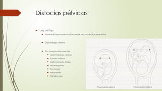Distocias pélvicas
 Ley de Pajot
 Nos explica porque mas frecuente en productos pequeños
 O patología uterina
 Factores predisponentes
 Malformaciones uterinas
 Tumores ováricos
 Malformaciones fetales
 Placenta previa
 Prematurez
 Hidrocefalia
 Polihidramnios
 