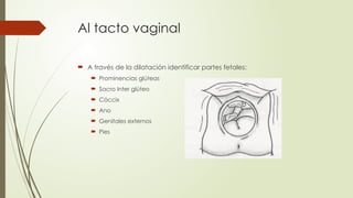 Al tacto vaginal
 A través de la dilatación identificar partes fetales:
 Prominencias glúteas
 Sacro Inter glúteo
 Cóccix
 Ano
 Genitales externos
 Pies
 