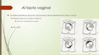 Al tacto vaginal
 Se debe identificar el punto toconomico de la presentación sacro cóccix
 Relacionarlo con la pelvis materna
 Conocer Variedad de posición
 RX y USG
 