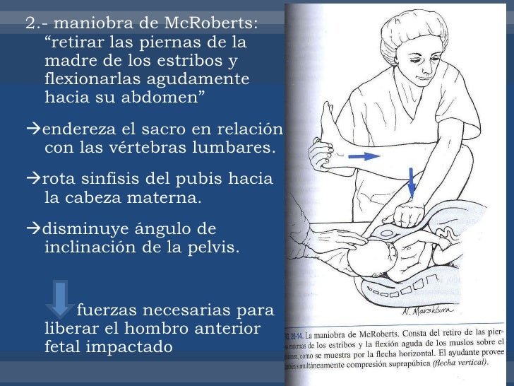 Distocias 4435