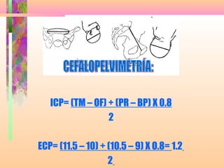ICP= (TM – OF) + (PR – BP) X 0.8
2
ECP= (11.5 – 10) + (10.5 – 9) X O.8= 1.2
2
 