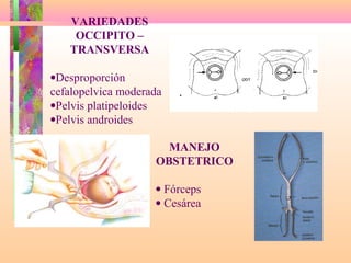 VARIEDADES
OCCIPITO –
TRANSVERSA
•Desproporción
cefalopelvica moderada
•Pelvis platipeloides
•Pelvis androides
MANEJO
OBSTETRICO
• Fórceps
• Cesárea
 