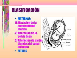 CLASIFICACIÓN
• MATERNAS:
1) Alteración de la
contractilidad
uterina
2) Alteración de la
pelvis ósea
3) Alteración de partes
blandas del canal
del parto
• FETALES
 