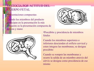 DISTOCIA POR ACTITUD DEL
CUERPO FETAL
•Presentaciones compuestas
Cuando los miembros del producto
participan en la presentación la más
frecuente es la presentación compuesta de
cabeza y mano
•Procúbito y procidencia de miembros
fetales
Cuando los miembros superiores o
inferiores descienden al orificio cervical y
esten integras las membranas, se designa
procúbito
Cuando se rompen las membranas y
ocurre la salida de un miembro atravéz del
cérvix se designa como procidencia de ese
mismo
 