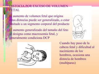 DISTOCIA POR EXCESO DE VOLUMEN
FETAL
El aumento de volumen fetal que origina
estas distocias puede ser generalizado, o estar
limitado a un segmento corporal del producto
El aumento generalizado del tamaño del feto
se designa como macrosomía fetal, y
generalmente condiciona DCP
Cuando hay paso de la
cabeza fetal y dificultad al
nacimiento de los
hombros, ocasiona una
distocia de hombros
(multíparas)
 