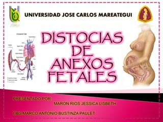 PRESENTADO POR:
MARON RIOS JESSICA LISBETH
OBS.MARCO ANTONIO BUSTINZA PAULET
 