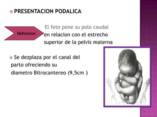  PRESENTACION PODALICA
El feto pone su polo caudal
en relacion con el estrecho
superior de la pelvis materna
 Se dezplaza por el canal del
parto ofreciendo su
diametro Bitrocantereo (9,5cm )
Definicion
 