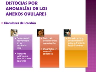  Circulares del cordón
• Desaceleracio
nes variables
en la
monitoría
fetal
• Signos de
sufrimiento
fetal sin causa
aparente
• Falta del
descenso de la
presentación
• Diagnóstico
ecografía
obstétrica
• Cuando no hay
encajamiento o
existe sufrimiento
fetal cesárea
 