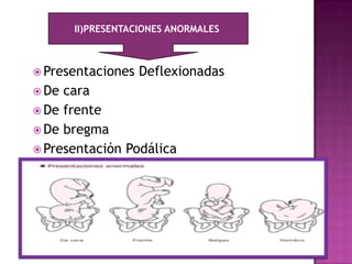  Presentaciones Deflexionadas
 De cara
 De frente
 De bregma
 Presentación Podálica
II)PRESENTACIONES ANORMALES
 