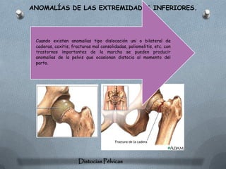 ANOMALÍAS DE LAS EXTREMIDADES INFERIORES.




 Cuando existen anomalías tipo dislocación uni o bilateral de
 caderas, coxitis, fracturas mal consolidadas, poliomelitis, etc. con
 trastornos importantes de la marcha se pueden producir
 anomalías de la pelvis que ocasionan distocia al momento del
 parto.




                      Distocias Pélvicas
 