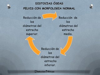 DISTOCIAS ÓSEAS
PELVIS CON MORFOLOGIA NORMAL


Reducción de                 Reducción de
      los                         los
diámetros del                diámetros del
  estrecho                     estrecho
   superior.                    medio.




             Reducción de
                   los
             diámetros del
                estrecho
                inferior.

        Distocias Pélvicas
 