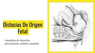 Distocias De Origen
Fetal
Anomalías de situación,
presentación, actitud y posición
 