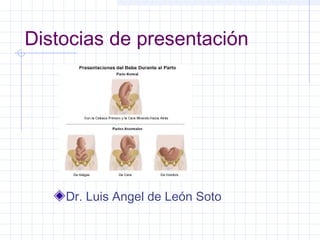 Distocias de presentación
Dr. Luis Angel de León Soto
 