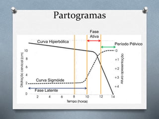 Partogramas 
Curva Hiperbólica 
Curva Sigmóide 
Fase Latente 
Fase 
Ativa 
Período Pélvico 
 