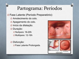 Partograma: Períodos 
O Fase Latente (Período Preparatório): 
O Amolecimento do colo. 
O Apagamento do colo. 
O Início da dilatação. 
O Duração: 
O Nulípara: 16-20h 
O Multípara: 12-16h 
O Disfunção: 
O Fase Latente Prolongada. 
 