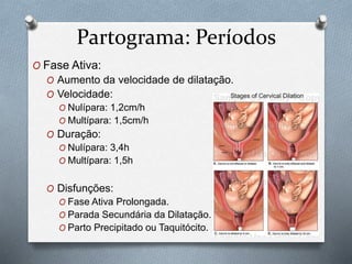 Partograma: Períodos 
O Fase Ativa: 
O Aumento da velocidade de dilatação. 
O Velocidade: 
O Nulípara: 1,2cm/h 
O Multípara: 1,5cm/h 
O Duração: 
O Nulípara: 3,4h 
O Multípara: 1,5h 
O Disfunções: 
O Fase Ativa Prolongada. 
O Parada Secundária da Dilatação. 
O Parto Precipitado ou Taquitócito. 
 