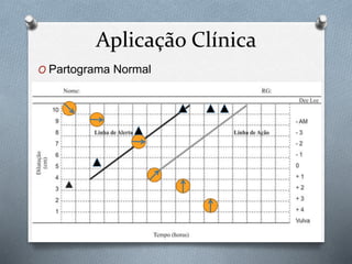 Aplicação Clínica 
O Partograma Normal 
 