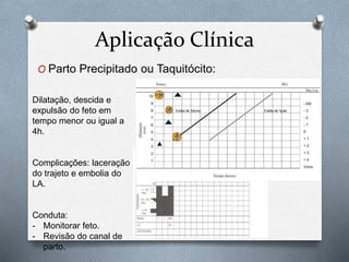 Aplicação Clínica 
O Parto Precipitado ou Taquitócito: 
Dilatação, descida e 
expulsão do feto em 
tempo menor ou igual a 
4h. 
Complicações: laceração 
do trajeto e embolia do 
LA. 
Conduta: 
- Monitorar feto. 
- Revisão do canal de 
parto. 
 