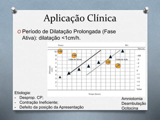 Aplicação Clínica 
O Período de Dilatação Prolongada (Fase 
Ativa): dilatação <1cm/h. 
Etiologia: 
- Desprop. CP; 
- Contração Ineficiente; 
- Defeito da posição da Apresentação 
Amniotomia 
Deambulação 
Ocitocina 
 