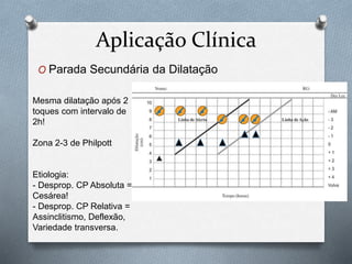 Aplicação Clínica 
O Parada Secundária da Dilatação 
Mesma dilatação após 2 
toques com intervalo de 
2h! 
Zona 2-3 de Philpott 
Etiologia: 
- Desprop. CP Absoluta = 
Cesárea! 
- Desprop. CP Relativa = 
Assinclitismo, Deflexão, 
Variedade transversa. 
 