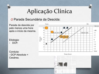 Aplicação Clínica 
O Parada Secundária da Descida: 
Parada da descida por 
pelo menos uma hora 
após o início da mesma. 
Etiologia: 
- DCP. 
Conduta: 
- DCP Absoluta = 
Cesárea. 
 