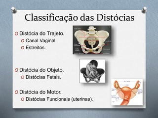 Classificação das Distócias 
O Distócia do Trajeto. 
O Canal Vaginal 
O Estreitos. 
O Distócia do Objeto. 
O Distócias Fetais. 
O Distócia do Motor. 
O Distócias Funcionais (uterinas). 
 