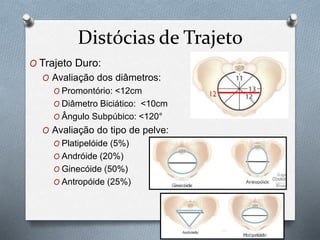 Distócias de Trajeto 
O Trajeto Duro: 
O Avaliação dos diâmetros: 
O Promontório: <12cm 
O Diâmetro Biciático: <10cm 
O Ângulo Subpúbico: <120° 
O Avaliação do tipo de pelve: 
O Platipelóide (5%) 
O Andróide (20%) 
O Ginecóide (50%) 
O Antropóide (25%) 
 