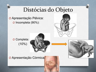Distócias do Objeto 
O Apresentação Pélvica: 
O Incompleta (90%): 
O Completa: 
(10%) 
O Apresentação Córmica 
 
