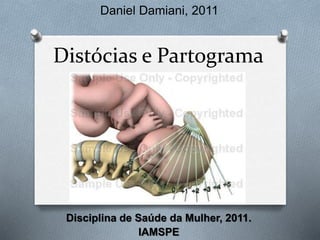Daniel Damiani, 2011 
Distócias e Partograma 
Disciplina de Saúde da Mulher, 2011. 
IAMSPE 
 