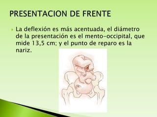 

La deflexión es más acentuada, el diámetro
de la presentación es el mento-occipital, que
mide 13,5 cm; y el punto de reparo es la
nariz.

 