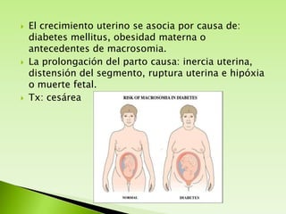 





El crecimiento uterino se asocia por causa de:
diabetes mellitus, obesidad materna o
antecedentes de macrosomia.
La prolongación del parto causa: inercia uterina,
distensión del segmento, ruptura uterina e hipóxia
o muerte fetal.
Tx: cesárea

 