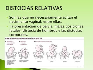 



Son las que no necesariamente evitan el
nacimiento vaginal, entre ellas:
la presentación de pelvis, malas posiciones
fetales, distocia de hombros y las distocias
corporales.

 