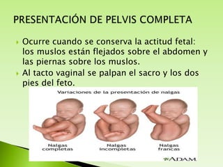



Ocurre cuando se conserva la actitud fetal:
los muslos están flejados sobre el abdomen y
las piernas sobre los muslos.
Al tacto vaginal se palpan el sacro y los dos
pies del feto.

 