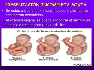 PRESENTACIÓN INCOMPLETA MIXTA
• En estos casos uno o ambos muslos, o piernas, se
encuentran extendidas.
• Al examen vaginal se puede encontrar el sacro y un
solo pie o ambos pies descendidos.
 