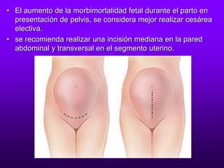• El aumento de la morbimortalidad fetal durante el parto en
presentación de pelvis, se considera mejor realizar cesárea
electiva.
• se recomienda realizar una incisión mediana en la pared
abdominal y transversal en el segmento uterino.
 