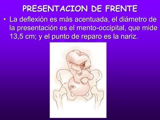 PRESENTACION DE FRENTE
• La deflexión es más acentuada, el diámetro de
la presentación es el mento-occipital, que mide
13,5 cm; y el punto de reparo es la nariz.
 
