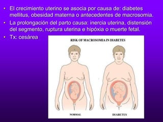 • El crecimiento uterino se asocia por causa de: diabetes
mellitus, obesidad materna o antecedentes de macrosomia.
• La prolongación del parto causa: inercia uterina, distensión
del segmento, ruptura uterina e hipóxia o muerte fetal.
• Tx: cesárea
 