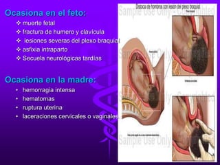 Ocasiona en el feto:
 muerte fetal
 fractura de humero y clavícula
 lesiones severas del plexo braquial
 asfixia intraparto
 Secuela neurológicas tardías
Ocasiona en la madre:
• hemorragia intensa
• hematomas
• ruptura uterina
• laceraciones cervicales o vaginales.
 