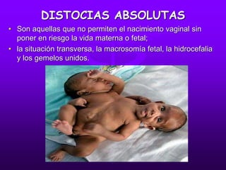 DISTOCIAS ABSOLUTAS
• Son aquellas que no permiten el nacimiento vaginal sin
poner en riesgo la vida materna o fetal;
• la situación transversa, la macrosomía fetal, la hidrocefalia
y los gemelos unidos.
 