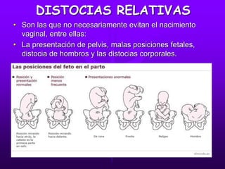DISTOCIAS RELATIVAS
• Son las que no necesariamente evitan el nacimiento
vaginal, entre ellas:
• La presentación de pelvis, malas posiciones fetales,
distocia de hombros y las distocias corporales.
 