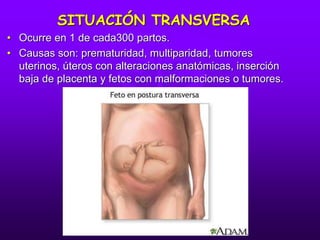 SITUACIÓN TRANSVERSA
• Ocurre en 1 de cada300 partos.
• Causas son: prematuridad, multiparidad, tumores
uterinos, úteros con alteraciones anatómicas, inserción
baja de placenta y fetos con malformaciones o tumores.
 