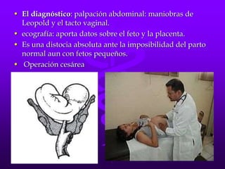 • El diagnóstico: palpación abdominal: maniobras de
Leopold y el tacto vaginal.
• ecografía: aporta datos sobre el feto y la placenta.
• Es una distocia absoluta ante la imposibilidad del parto
normal aun con fetos pequeños.
• Operación cesárea
 