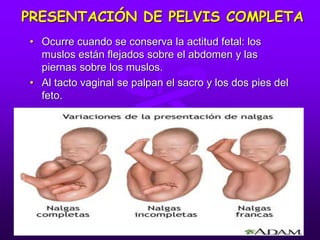 PRESENTACIÓN DE PELVIS COMPLETA
• Ocurre cuando se conserva la actitud fetal: los
muslos están flejados sobre el abdomen y las
piernas sobre los muslos.
• Al tacto vaginal se palpan el sacro y los dos pies del
feto.
 