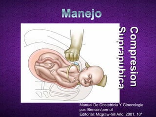Compresion Suprapubica Manual De Obstetricia Y Ginecologia por: Benson/pernoll Editorial: Mcgraw-hill Año: 2001, 10ª  edición) 