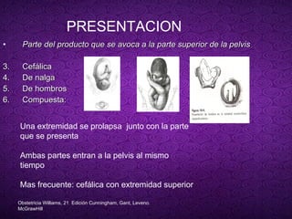 PRESENTACION Parte del producto que se avoca a la parte superior de la pelvis . Cefálica De nalga De hombros Compuesta: Una extremidad se prolapsa  junto con la parte que se presenta Ambas partes entran a la pelvis al mismo tiempo Mas frecuente: cefálica con extremidad superior Obstetricia Williams, 21  Edición Cunningham, Gant, Leveno. McGrawHill 