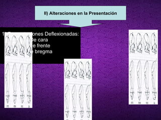 1) Presentaciones Deflexionadas:  De cara  De frente  De bregma  II) Alteraciones en la Presentación 