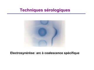 Techniques sérologiques




Electrosynérèse: arc à coalescence spécifique
 